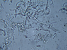 Trichophyton mentagrophytes