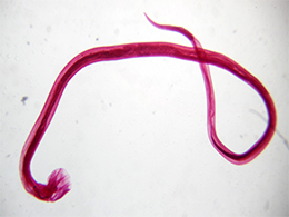 Trichostrongylus